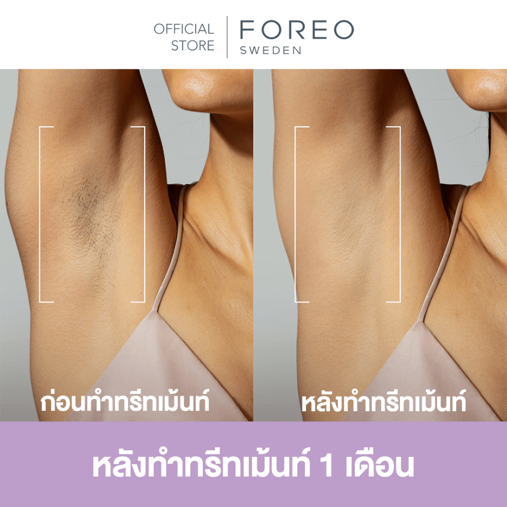 เครื่องกำจัดขน IPL FOREO PEACH 2 GO Lavender